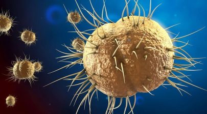 Gonorrhea or gonorrhea