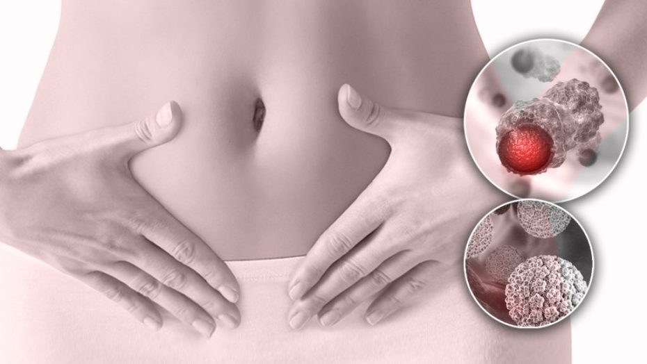 درمان زگیل تناسلی با دکتر مدبری